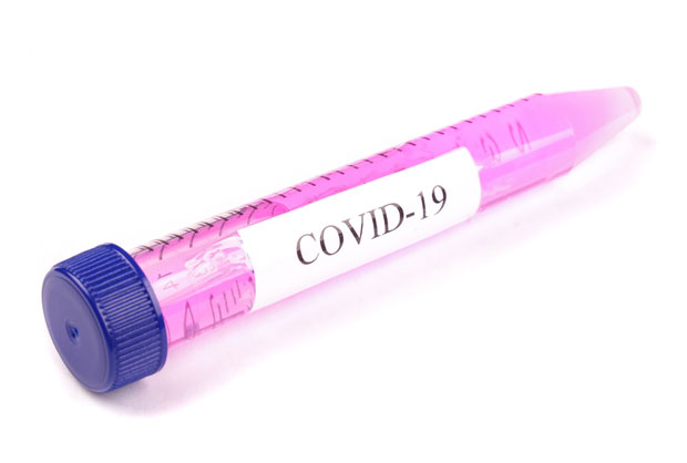 Четири нова случајева заразе короном на Косову